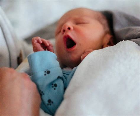 Why Is My Newborn Baby Skin Red? Exploring the 7 Causes for Better Care ...