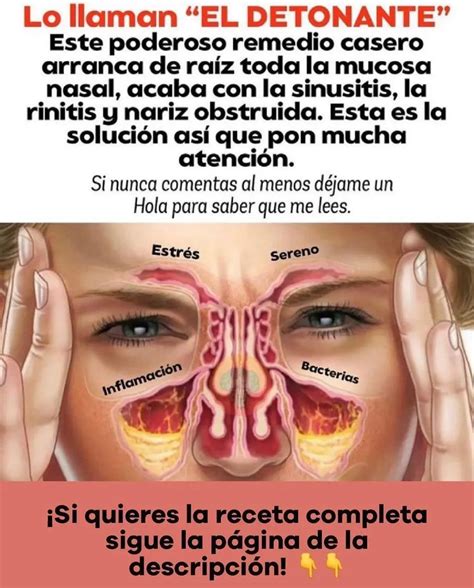 Sinusitis: Imágenes Reales Y Cómo Detectarla | Doctor Online