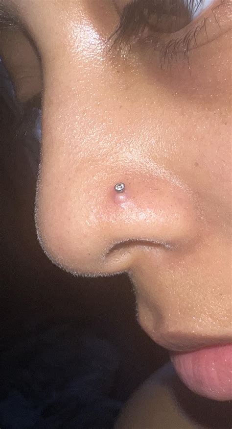 Bump on nose piercing : r/piercing