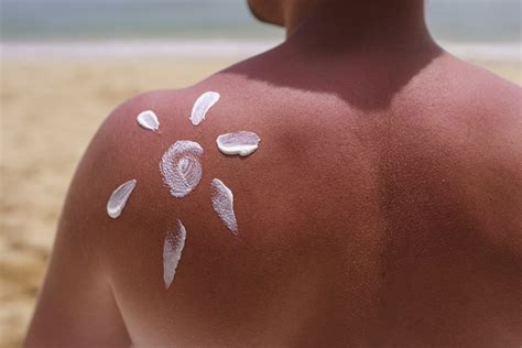 Sunburn: What Is, Symptoms, Degrees, and First Aid