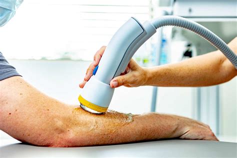 How Much Does SoftWave Therapy Cost? (2026)