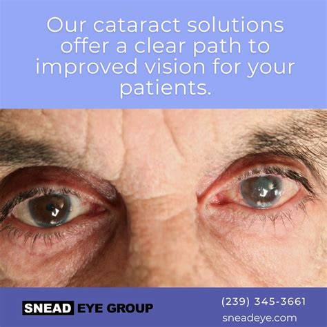 Snead Eye Group on LinkedIn: #sneadeyegroup #eyecare #eye #vision # ...