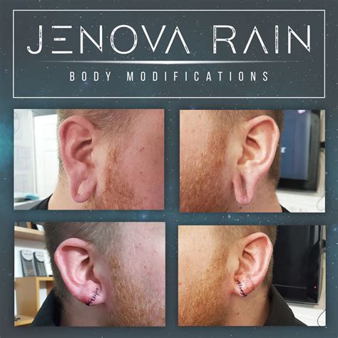 Big holes removed from ear lobes by ear lobe reconstruction in leicester uk by jenova rain 22mm ...