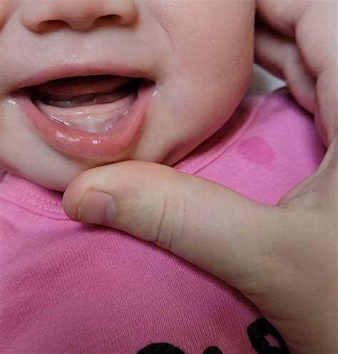 Top 93+ Pictures Pictures Of Babies Gums When Teething Latest