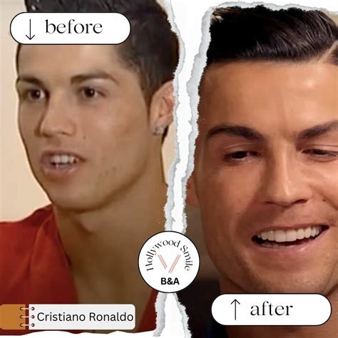 Cristiano Ronaldo Face Surgery