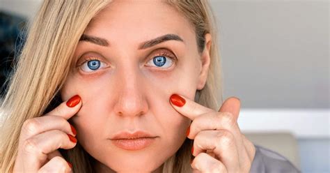 Baggy Eyes How To Reduce Puffy Eyes | SheerLuxe