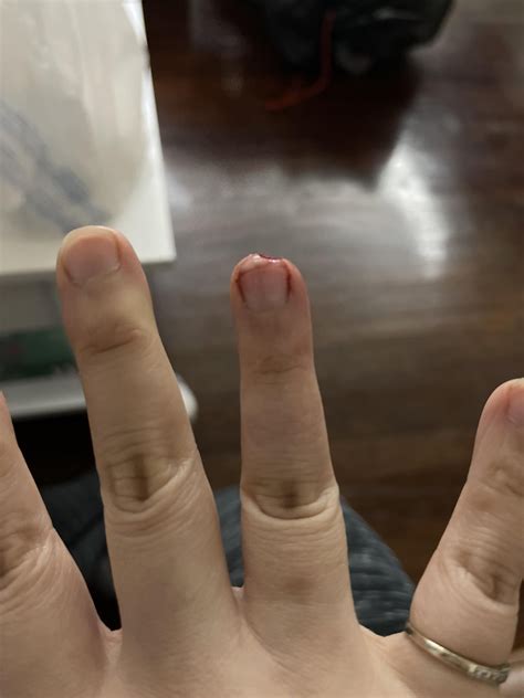 Always use the guard or glove with the mandolin😩. First time mandolin ...