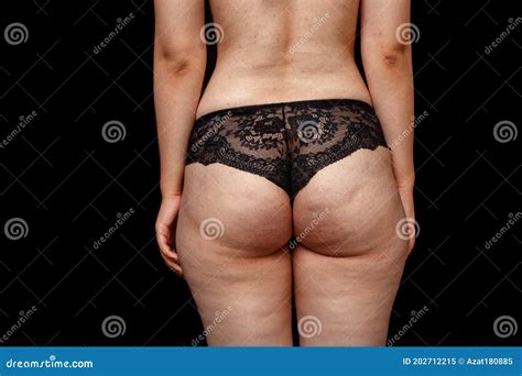 Young Woman in Underwear. Rear View . Buttocks with Cellulite and Excess Weight. on a Black ...