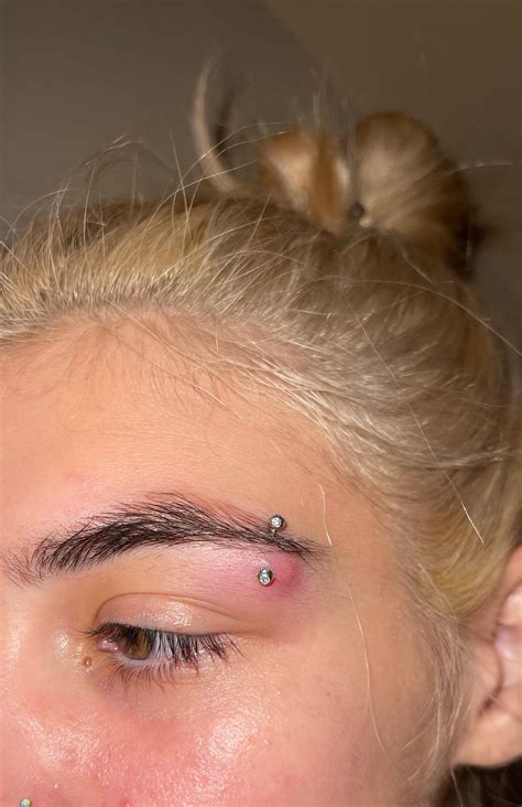 Eyebrow Piercing Infection Eyebrow Piercing🪄