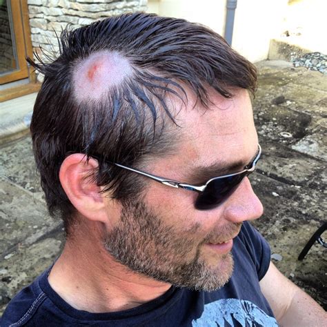 Charlie Hamilton James: The Disgusting Disease Diaries, Part One ...