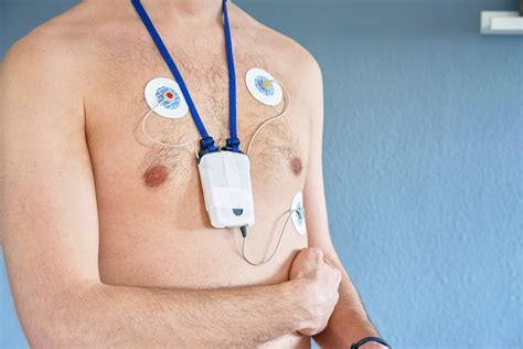 Holter EKG Warszawa - Kardiolog Warszawa