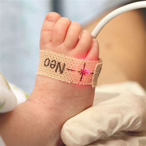 Type of Pulse Ox Matters for Newborn Heart Defect Screening | Heart ...