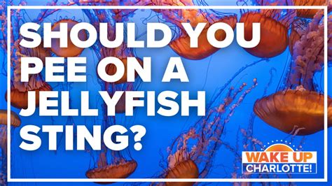 Jelly fish sting: Should you pee on it? | wcnc.com