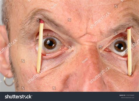 Eyes Propped Open With Toothpicks