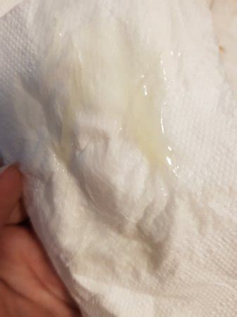 mucus plug vs discharge - prenatal vitamins