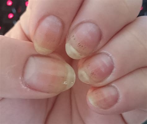 ASK ANA: Black Spots In Nails | Nail Care HQ
