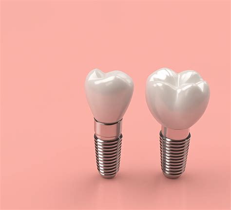 Calcium Deposits on Teeth: Causes, Effects, and Treatment? | LEMA