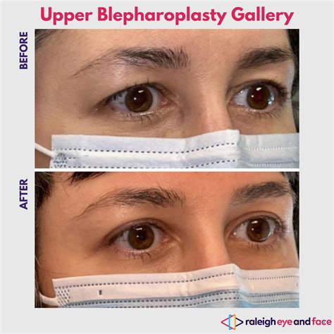 Gallery Menu — Raleigh Eye and Face