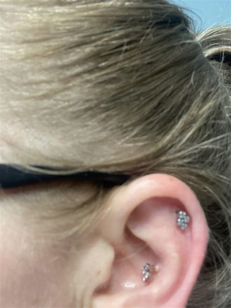 Irritation bump? : r/piercing