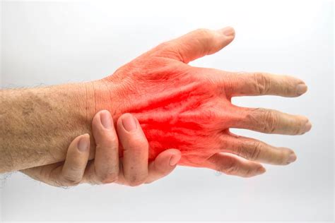 Tendonitis of the Hand & Wrist - Center for Advanced Orthopedics
