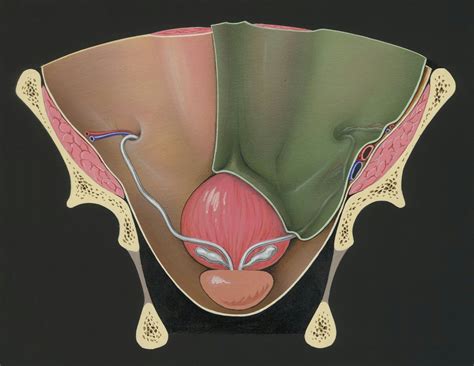 Pelvic Floor Dry Needling for Urinary Dysfunction | Acupuncturist St ...