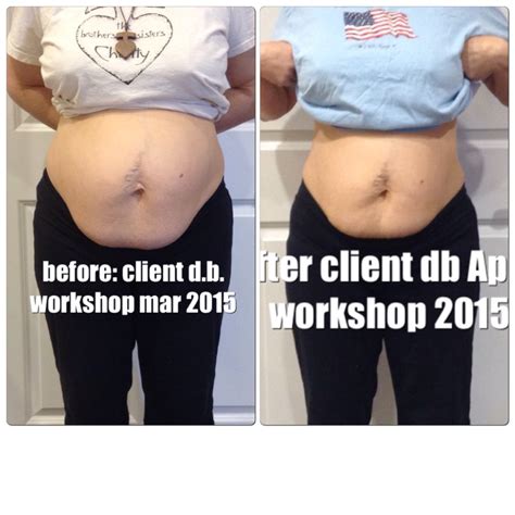 All New Before and After Pictures – Healing the Diastasis Recti 2015 – Beautiful After the Belly
