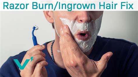 Getting Rid Of Razor Burn and Ingrown Hairs | Shaving 101