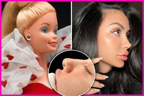 Barbie Face Surgery
