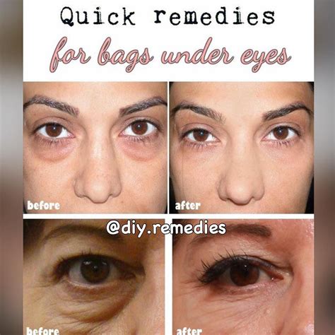 DIY REMEDIES on Instagram: “Unfortunately, many women face the ...