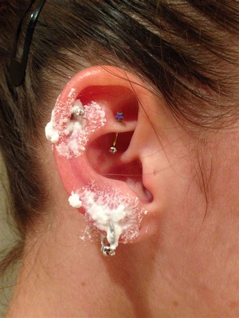 Crushed Aspirin And Water Keloid at Daniel Gilmore blog