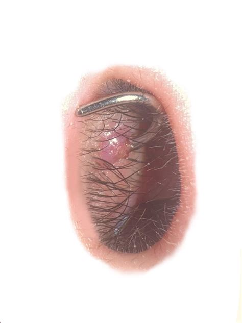 Nose piercing bump!! Inside nose?? (COMMENTS!) : r/piercing