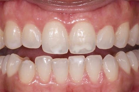 Cosmetic Dentistry — Centro Dental