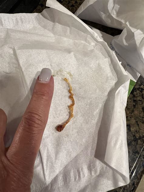 Omg! I can hear again! : r/earwax