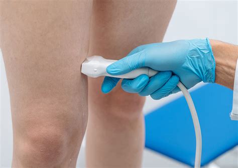 May-Thurner Syndrome | Fox Valley Surgical
