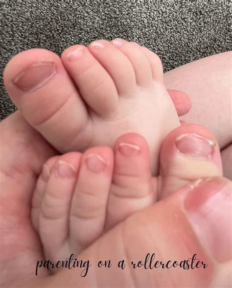 Causes Of Brittle Nails In Babies at Sherman Cleveland blog