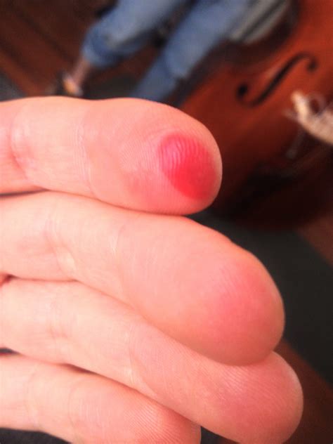 "I've got blisters on my fingers!" • George Mandis