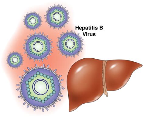 Hepatitis B Symptoms, Treatment, Causes, What is Hepatitis B | STD-Gov.org