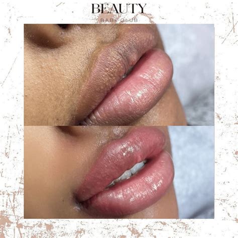 Purple Spots On Lips From Smoking | Lipstutorial.org