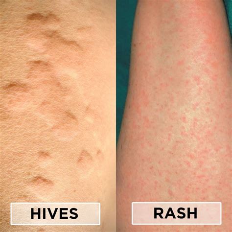 Probity Medical Research Inc. on LinkedIn: How do you know if you have ...