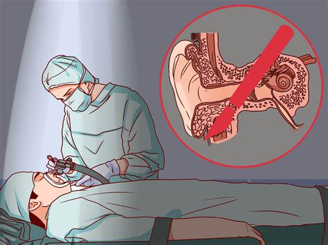 How to Cure Labyrinthitis: 14 Steps (with Pictures) - wikiHow