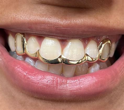 Pin by Tyara Walker on Grillz in 2024 | Gold teeth grillz, Dental ...