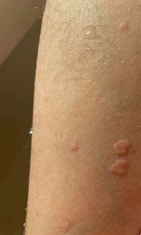 Weird bumps : r/skin