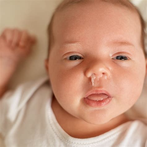 Milk Blister Baby Lip