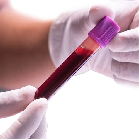 Blood Tests CS Archives | YaraOnline