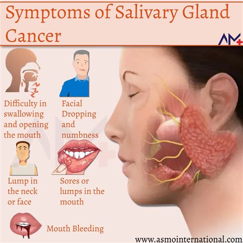 Salivary Gland Cancer Tumor