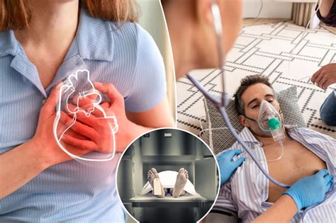 What is SADI-S? Surgery for more weight loss than gastric sleeve