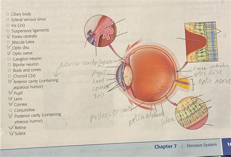 Solved ﻿Ciliary body ﻿Scleral venous sinuslris | Chegg.com