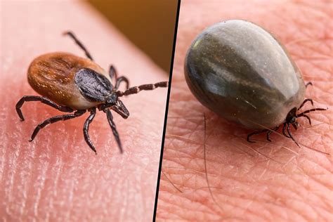 Why This Tick Season Is Worse - and How to Protect Yourself