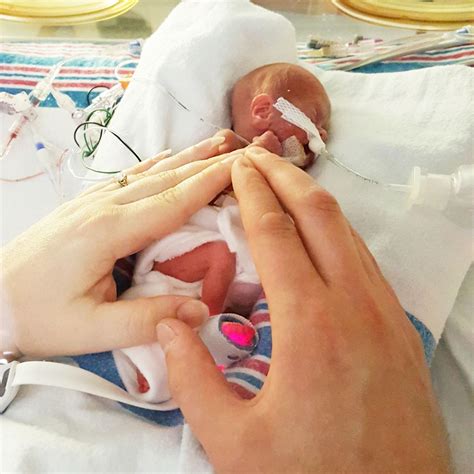 These Pictures Of A Healthy "Micro Preemie" Baby Are Everything
