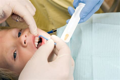 Fluoride Treatment For Kids